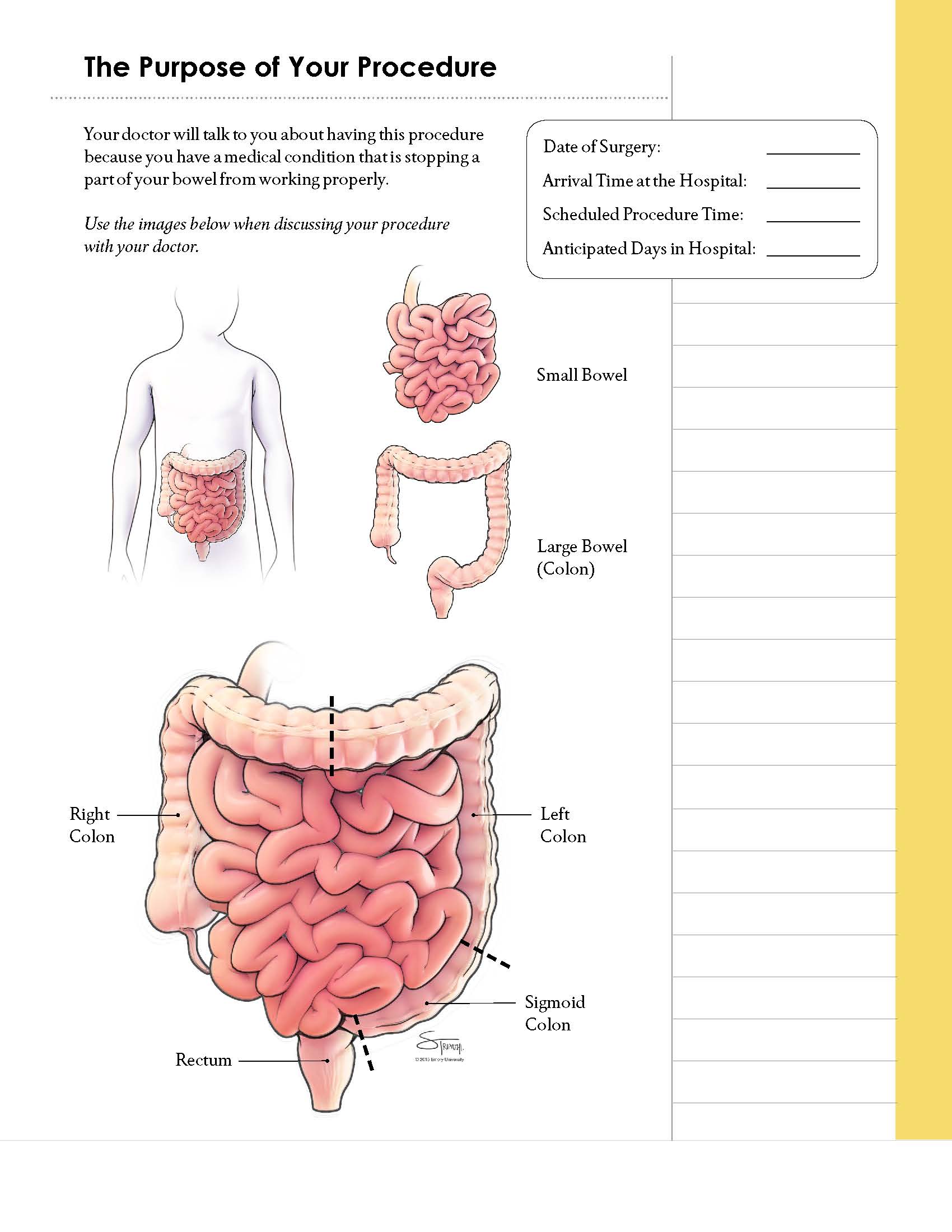 The Purpose of Your Procedure:  A page from a larger patient education guide. This page depicts the anatomy of the digestive system including the small bowel and the large bowel (colon)