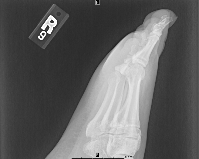Toothpick in foot XR lateral not seen