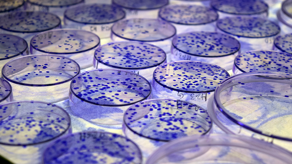 Image of petri dishes.