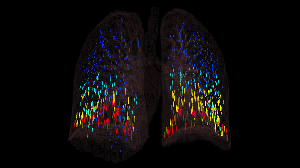 4DCT1 lung rendering