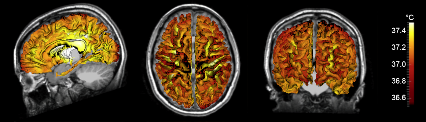 Above: A 3D brain temperature map of a human subject, overlaid on their anatomical brain structure. Candace Fleischer’s team inputs these MRI data into their novel biophysical model to simulate personalized brain temperature maps for each person
